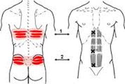 Understanding the Low Back Pain Trigger Points
